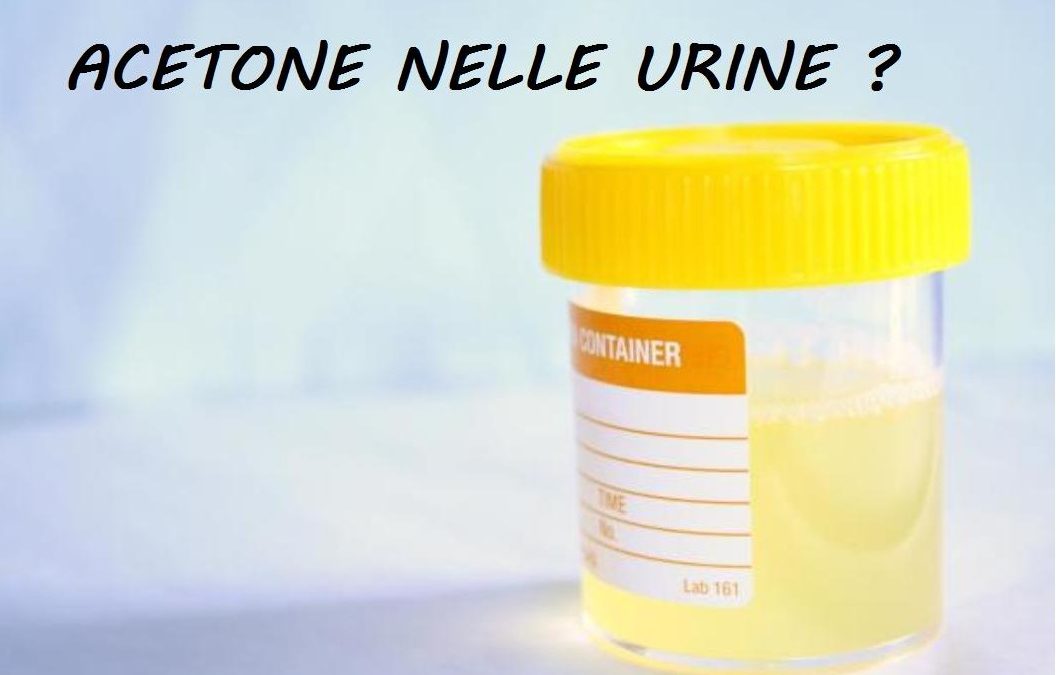 ACETONE NELLE URINE ? Laboratorio Suzzi